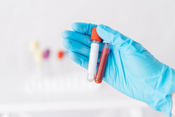 When To Seek Blood Clot Treatment
