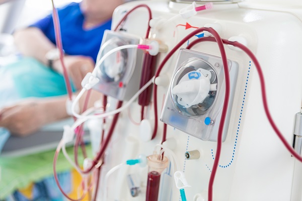 What To Expect Before Receiving Dialysis